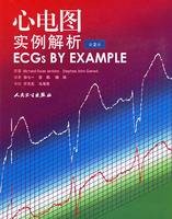 心电图实例解析
