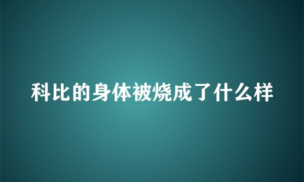 科比的身体被烧成了什么样