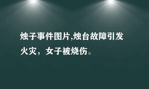 烛子事件图片,烛台故障引发火灾，女子被烧伤。