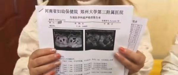怀八胞胎女子仅18岁 曾打促排卵针 这是咋情况？