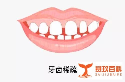 春节七天的真实写照,快来看看你是哪一种?