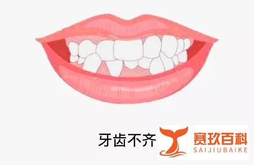春节七天的真实写照,快来看看你是哪一种?