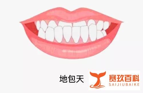 春节七天的真实写照,快来看看你是哪一种?