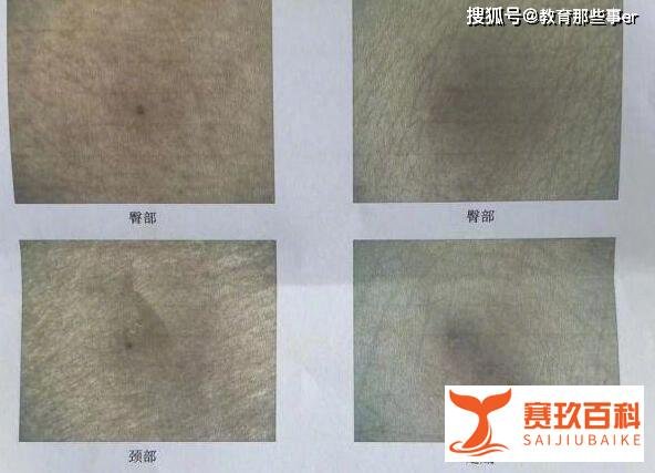 深圳一幼童疑遭扎针 这是咋情况？