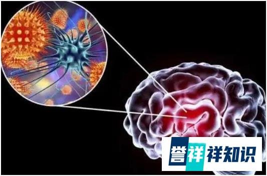 我国发现多例新型尼帕病毒感染者,尼帕病毒致死率高达75%